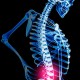 somerville thai massage chronic low back pain